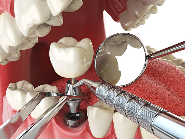 Best Emergency Denture Repair in Oakhurst, NJ